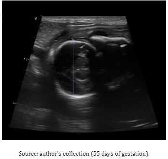 Figure 1 - Measurement of the largest cross-section between the two parietal bones of the skull, based on the differentiation of the head and body of the canine fetus, to obtain the biparietal diameter (BPD) and estimate the gestational age using the formula: “BPD x 15 + 20”, obtained automatically by the device software.